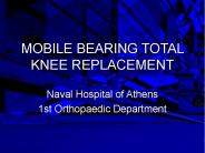 MOBILE BEARING TOTAL KNEE REPLACEMENT