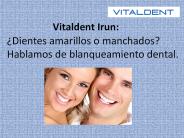 Vitaldent Irun: Blanqueamiento dental