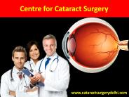 Centre for Cataract surgery in Delhi