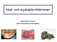 Hud- och mjukdelsinfektioner PowerPoint PPT Presentation