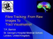 Inferring cerebral white matter connectivity using the diffusion tensor model