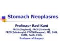 Stomach Neoplasms PowerPoint PPT Presentation