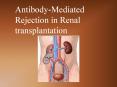 Antibody-Mediated Rejection in Renal transplantation PowerPoint PPT Presentation