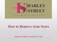 How to Remove Acne Scars PowerPoint PPT Presentation