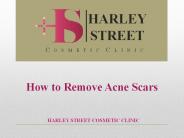 How to Remove Acne Scars