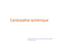 Cardiopathie isch