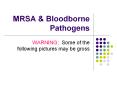 MRSA PowerPoint PPT Presentation