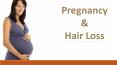 Pregnancy & Hair Fall - Pregnancy Tips & Guide - Mumzone PowerPoint PPT Presentation