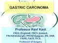 GASTRIC CARCINOMA PowerPoint PPT Presentation