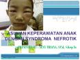 ASUHAN KEPERAWATAN ANAK DENGAN SYNDROMA NEFROTIK  PRESENTED BY : NENY TRIANA, SP.d, S.Kep.Ns PowerPoint PPT Presentation