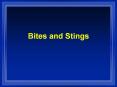 Bites and Stings PowerPoint PPT Presentation