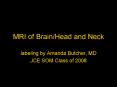 MRI of Brain/Head and Neck PowerPoint PPT Presentation