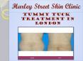 Tummy Tuck Treatment London- Harley Street Skin Clinic PowerPoint PPT Presentation