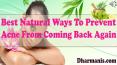Best Natural Ways To Prevent Acne From Coming Back Again PowerPoint PPT Presentation