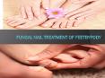 Fungal nail treatment of FeetByPody PowerPoint PPT Presentation