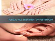Fungal nail treatment of FeetByPody