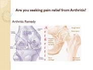Are you seeking pain relief from Arthritis?