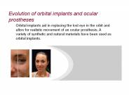 Evolution of orbital implants and ocular prostheses