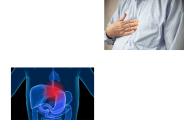 Rapid Reflux Relief
