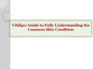 Vitiligo: Guide to Fully Understanding the Common Skin Condition