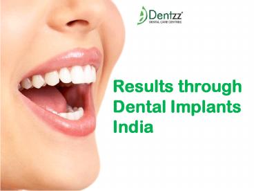Results through Dental Implants India (1)