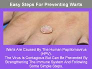 Easy Steps For Preventing Warts