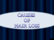 Causes of Hair Loss