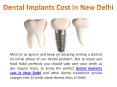32 Dental Hospital for Right Implants Cost in New Delhi PowerPoint PPT Presentation