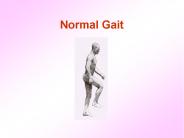 Normal Gait