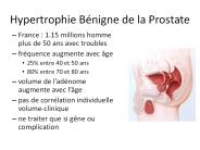 Hypertrophie B
