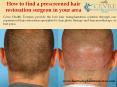 How to find a prescreened hair restoration surgeon in your area PowerPoint PPT Presentation