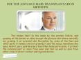 FUE the Advance Hair Transplantation Methods PowerPoint PPT Presentation