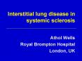 Interstitial lung disease in systemic sclerosis PowerPoint PPT Presentation