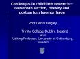 Challenges in childbirth research  PowerPoint PPT Presentation