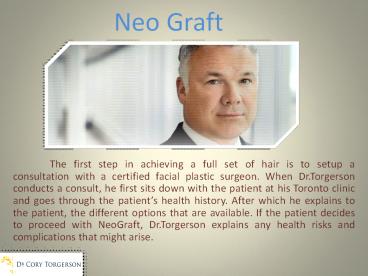 Neo Graft