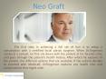 Neo Graft PowerPoint PPT Presentation