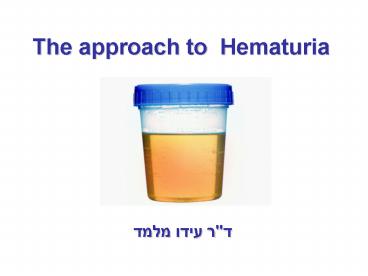 Hematuria The approach to