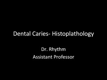 Dental Caries- Histoplathology