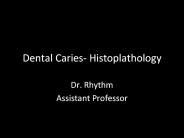 Dental Caries- Histoplathology