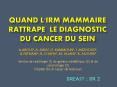 QUAND L'IRM mammaire rattrape LE DIAGNOSTIC DU CANCER DU SEIN PowerPoint PPT Presentation