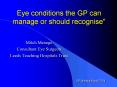 Eye conditions the GP can manage or should recognise" PowerPoint PPT Presentation