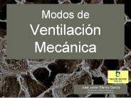 Modos de  Ventilaci