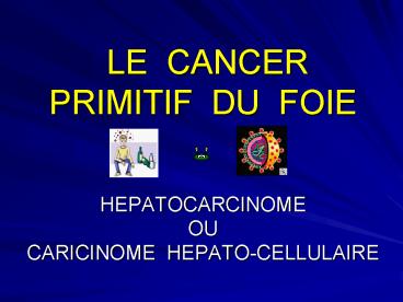 LE CANCER PRIMITIF DU FOIE   HEPATOCARCINOME OU  CARICINOME HEPATO-CELLULAIRE