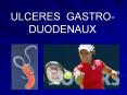 ULCERES GASTRO-DUODENAUX PowerPoint PPT Presentation