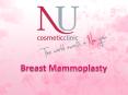 Advanced Breast Reduction Surgery is a Solution for Over- Sized Breasts PowerPoint PPT Presentation