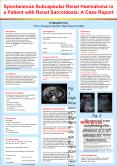 Spontaneous Subcapsular Renal Haematoma in a Patient with Renal Sarcoidosis: A Case Report PowerPoint PPT Presentation