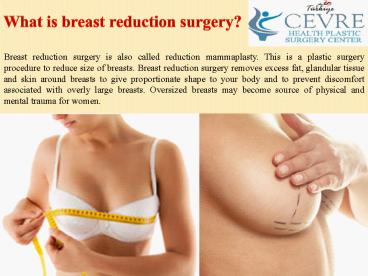 What is breast reduction surgery