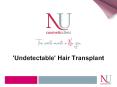 Hair Transplant Surgery - Bits & Pieces About Hair Restoration PowerPoint PPT Presentation