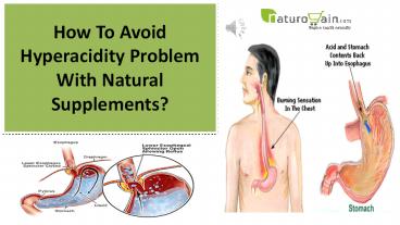How To Avoid Hyperacidity Problem With Natural Supplements?