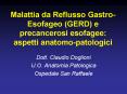 Malattia da Reflusso Gastro-Esofageo (GERD) e precancerosi esofagee: aspetti anatomo-patologici PowerPoint PPT Presentation
